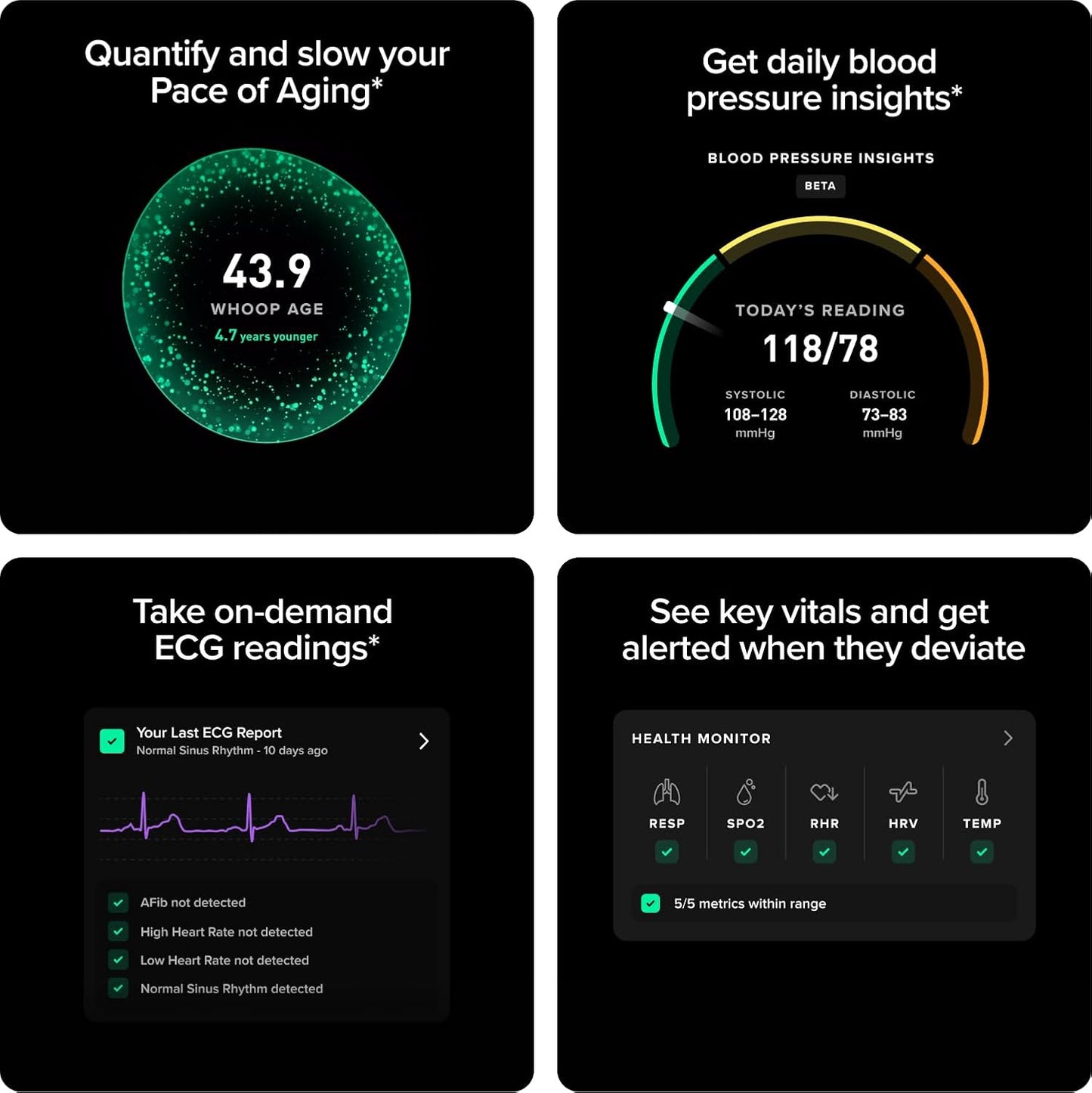 MG Activity Tracker - 12 Month Membership - Health and Fitness Wearable – 24/7 Activity and Sleep Tracker, Personalized Coaching, Menstrual Cycle Insights – 14+ Days Battery Life