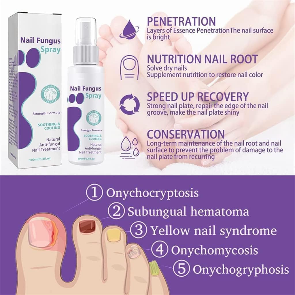 Nail Fungal Spray, Fungal Nail Treatment, Advanced Foot and Nail Spray, Toenail Fungus Treatment, Toenail Fungus Treatment and Nail Strengthener, Restore Healthy Nails (100ml)"
