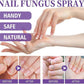 Nail Fungal Spray, Fungal Nail Treatment, Advanced Foot and Nail Spray, Toenail Fungus Treatment, Toenail Fungus Treatment and Nail Strengthener, Restore Healthy Nails (100ml)"