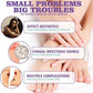 Nail Fungal Spray, Fungal Nail Treatment, Advanced Foot and Nail Spray, Toenail Fungus Treatment, Toenail Fungus Treatment and Nail Strengthener, Restore Healthy Nails (100ml)"