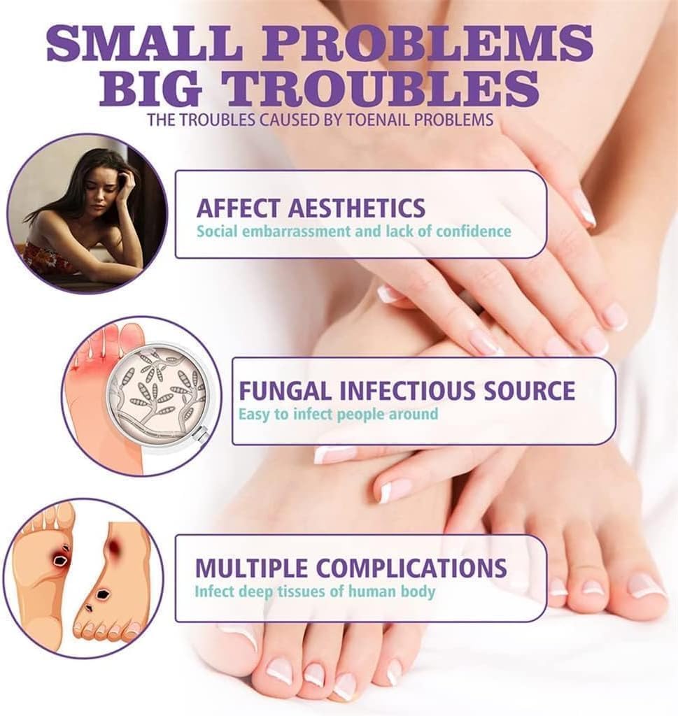 Nail Fungal Spray, Fungal Nail Treatment, Advanced Foot and Nail Spray, Toenail Fungus Treatment, Toenail Fungus Treatment and Nail Strengthener, Restore Healthy Nails (100ml)"