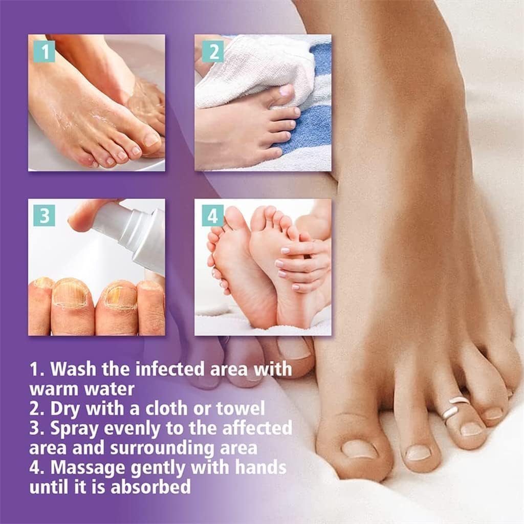 Nail Fungal Spray, Fungal Nail Treatment, Advanced Foot and Nail Spray, Toenail Fungus Treatment, Toenail Fungus Treatment and Nail Strengthener, Restore Healthy Nails (100ml)"