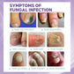 Nail Fungal Spray, Fungal Nail Treatment, Advanced Foot and Nail Spray, Toenail Fungus Treatment, Toenail Fungus Treatment and Nail Strengthener, Restore Healthy Nails (100ml)"