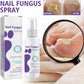 Nail Fungal Spray, Fungal Nail Treatment, Advanced Foot and Nail Spray, Toenail Fungus Treatment, Toenail Fungus Treatment and Nail Strengthener, Restore Healthy Nails (100ml)"