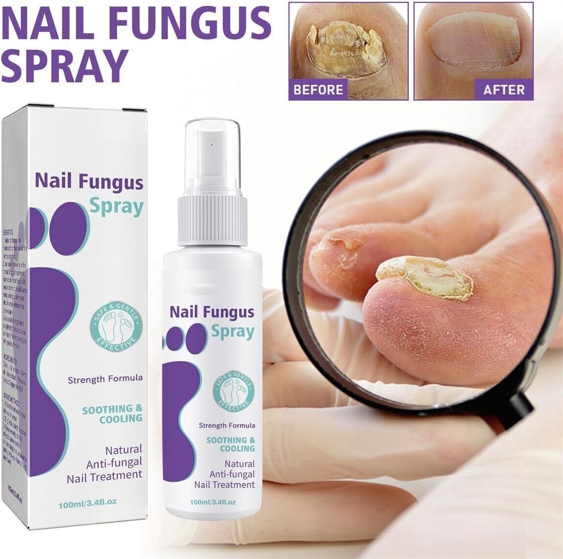 Nail Fungal Spray, Fungal Nail Treatment, Advanced Foot and Nail Spray, Toenail Fungus Treatment, Toenail Fungus Treatment and Nail Strengthener, Restore Healthy Nails (100ml)"